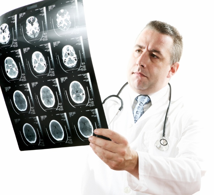 Un docteur regarde une radiographie
