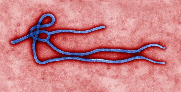Virus Ebola amplifié