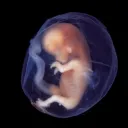 Un bébé dans l'utérus