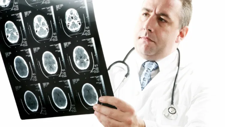 Un docteur regarde une radiographie